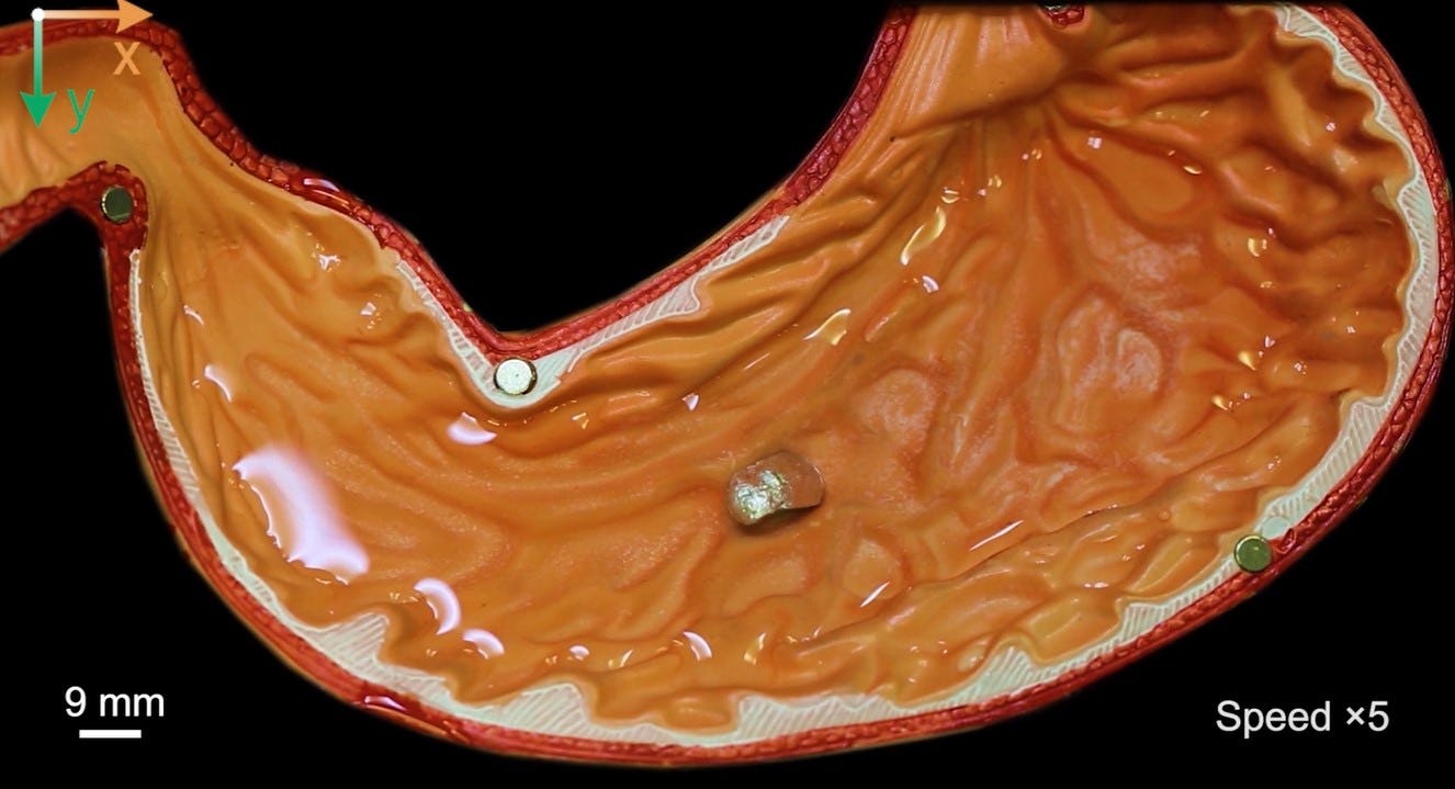 A small, square-shaped robot sits in a model stomach