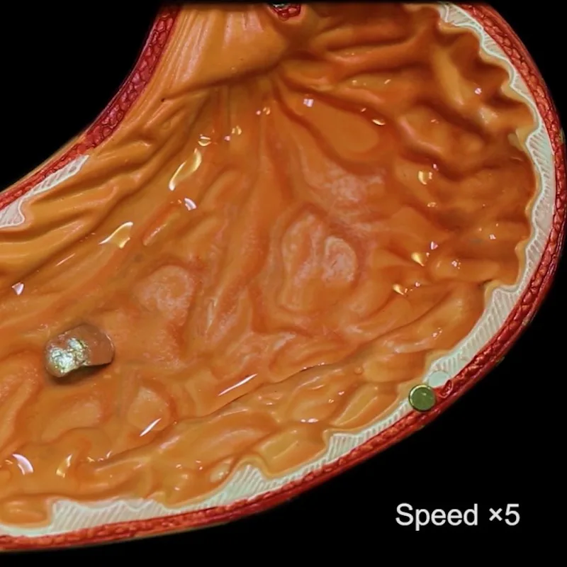 A small, square-shaped robot sits in a model stomach