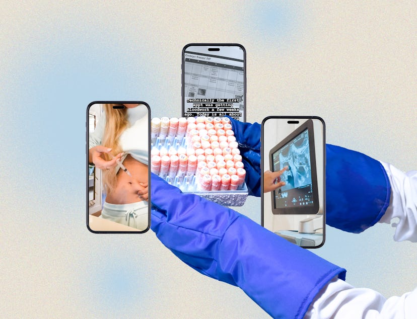 Influencers are documenting the egg freezing process, from the cost of egg freezing to egg retrieval...