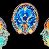 Brain scans