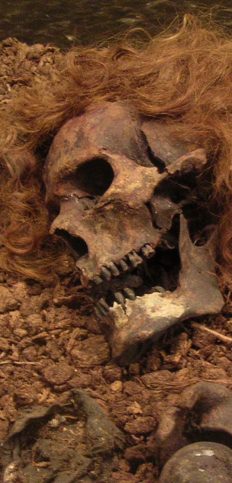 Bocksten Man, a remarkably well-preserved bog skeleton from Sweden.