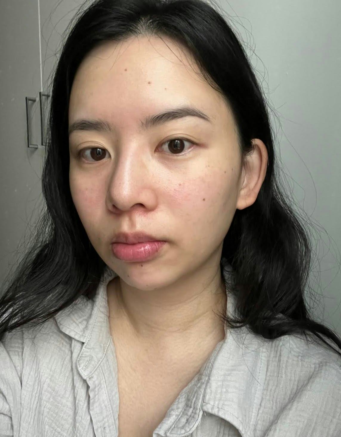 NIRA Pro Laser Review An AtHome Skin Device That Smooths Fine Lines