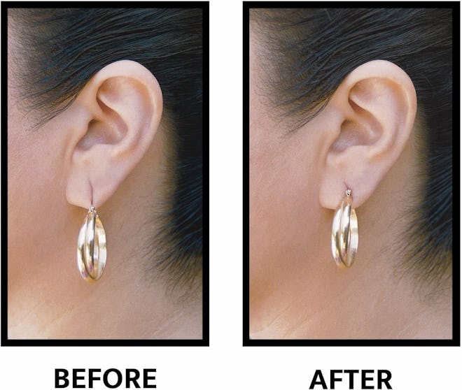 Lobe Wonder - The ORIGINAL Ear Lobe Support Patch for Pierced Ears
