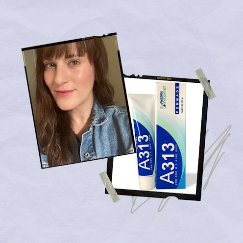 An honest review of the famous A313 retinol cream, one of France's best-kept beauty secrets.