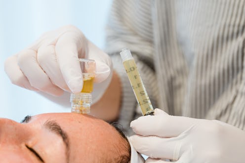 PRP facial being injected