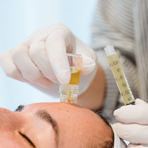 PRP facial being injected