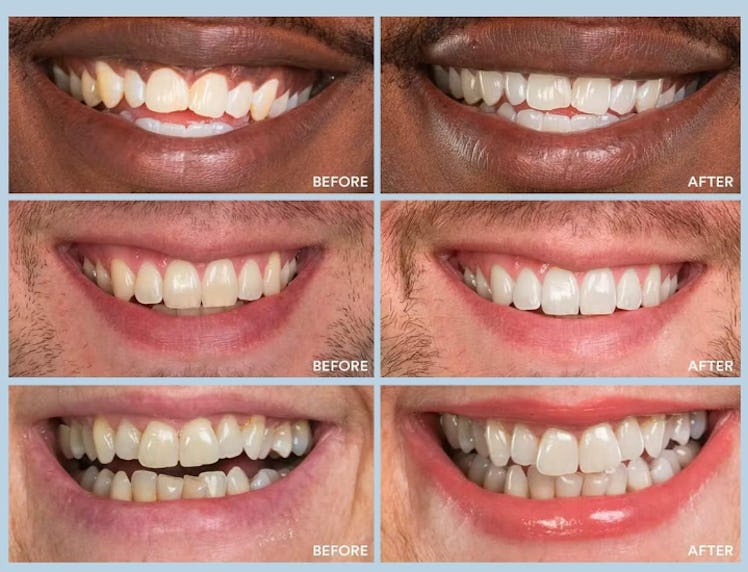 Auraglow Whitening Toothpaste Booster
