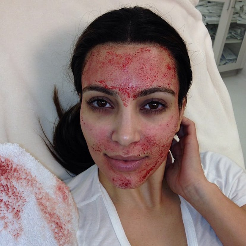 Kim Kardashian vampire facial selfie