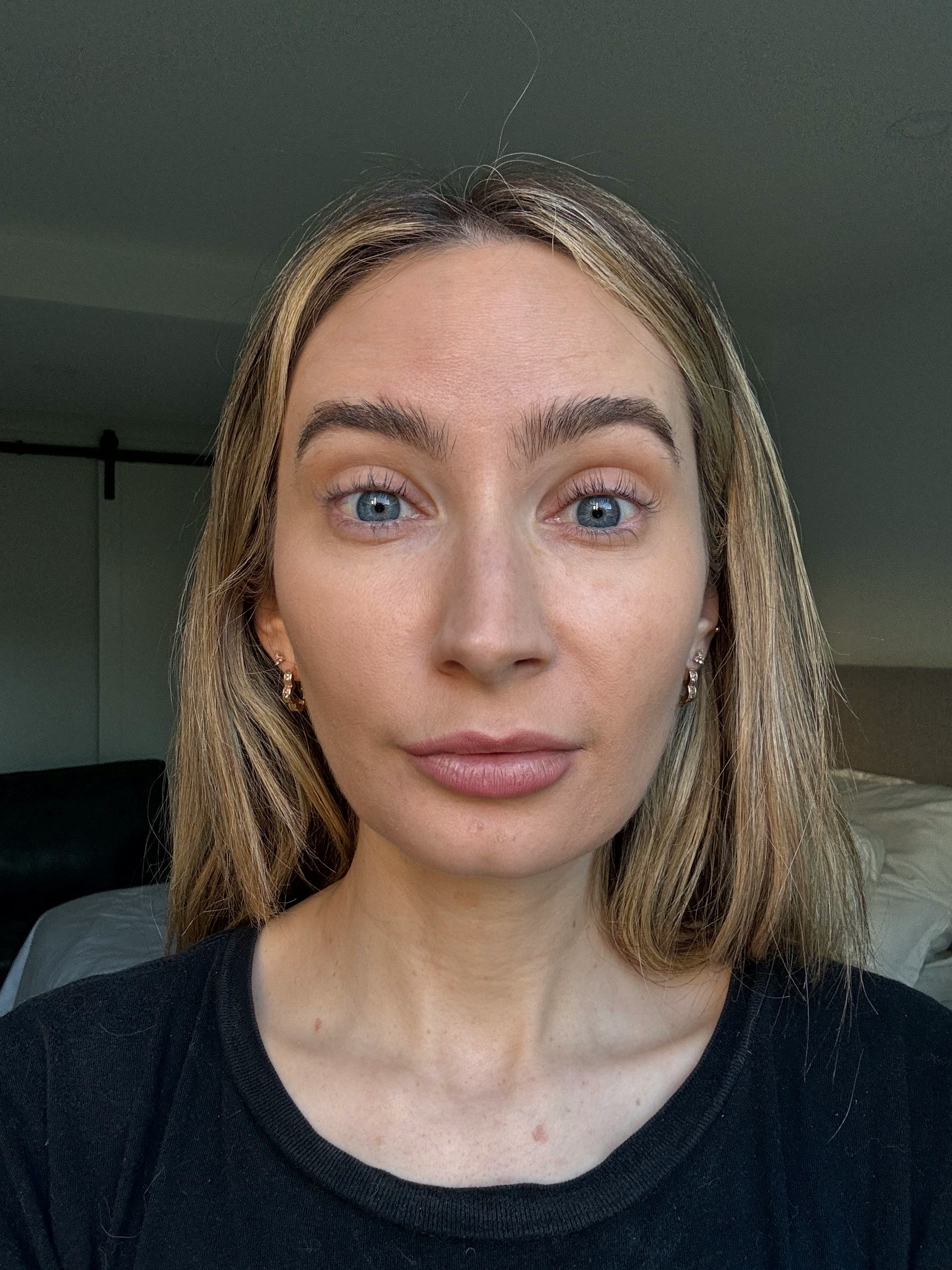 daxxify before and after 