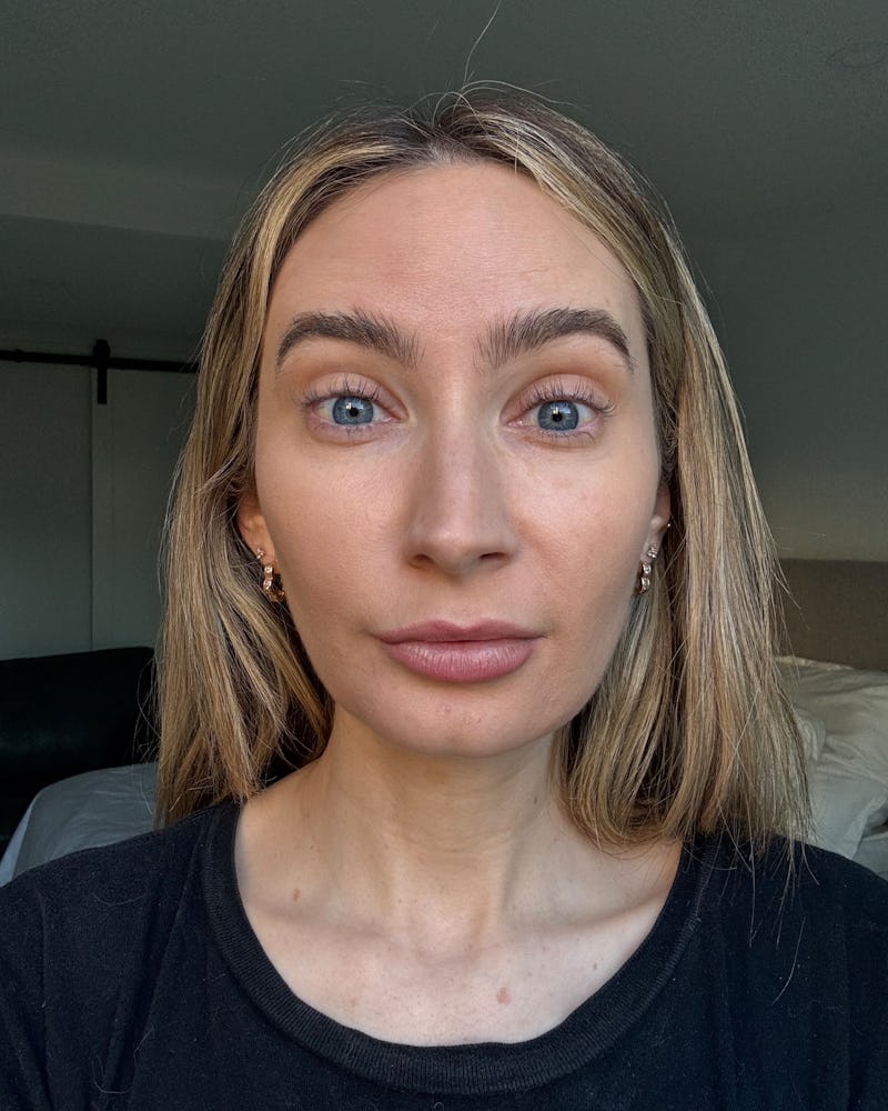 daxxify before and after