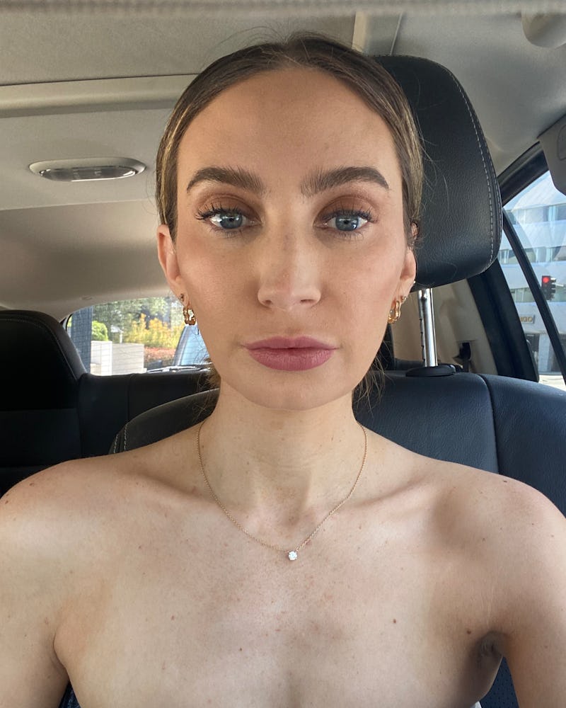 daxxify before and after