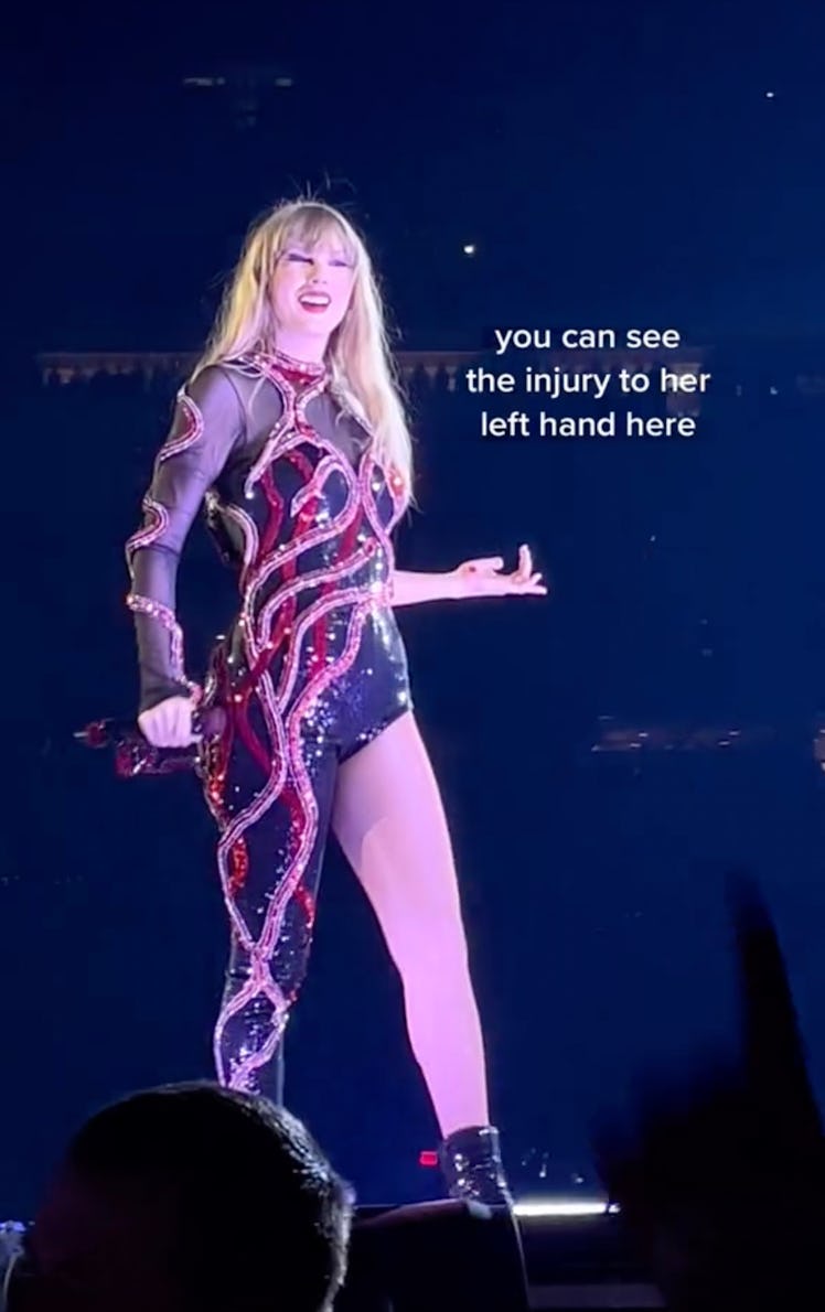 Taylor Swift injured her hand during her Houston show.