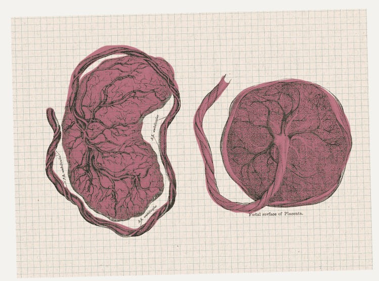 Two medical drawings of placentas