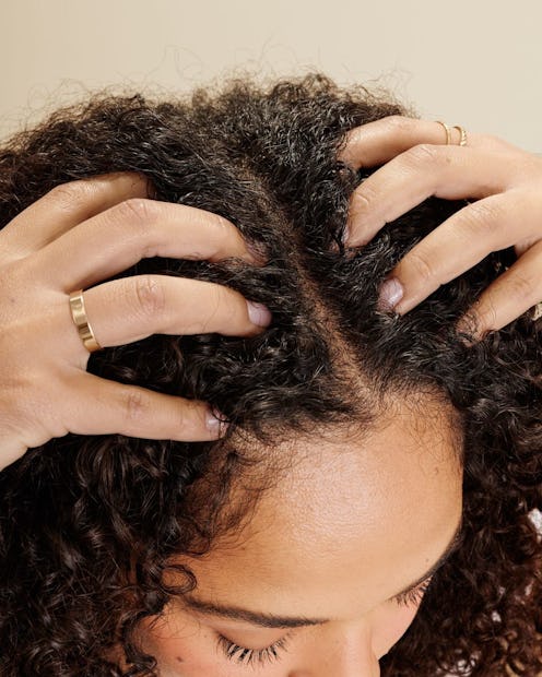 how to treat dry scalp natural hair