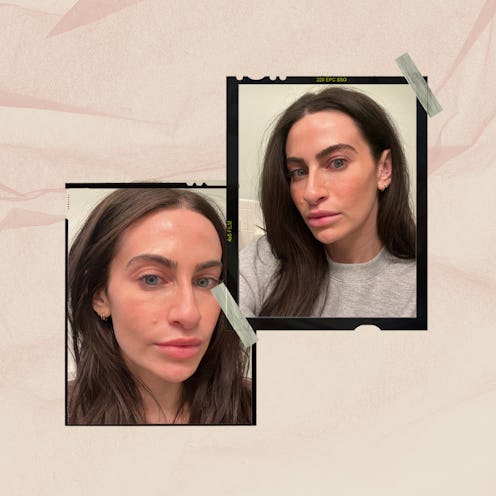 An honest review of Daxxify, the longer-lasting alternative to Botox.