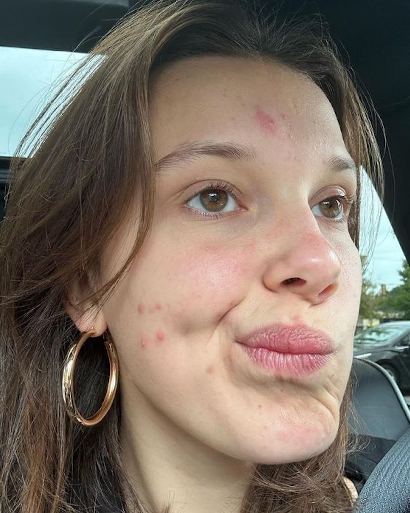 In Oct. 2023, Millie Bobby Brown shared a relatable acne-positive selfie on Instagram.
