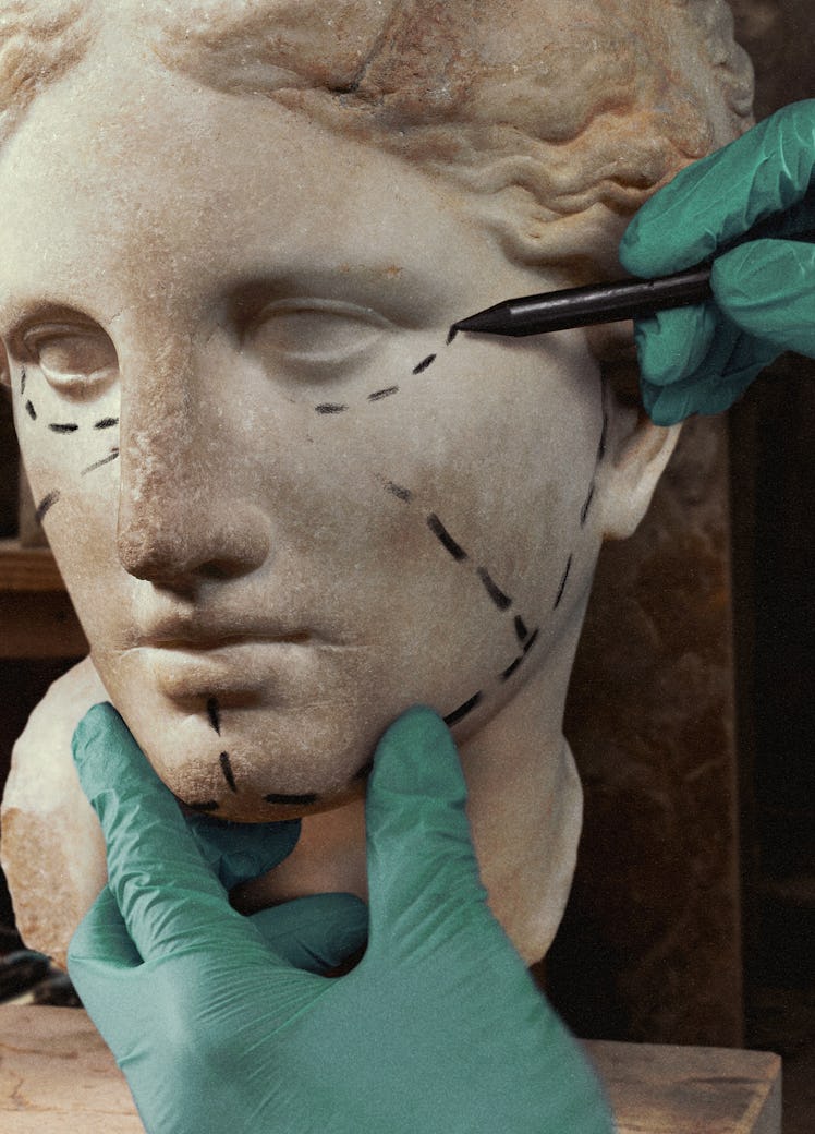 Close-up of a classical sculpture's face with marked lines resembling surgical guides, as a hand in ...