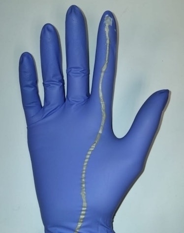 An image of the glove with a sensor to determine the baby's positioning before birth.