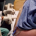 A pregnant person getting an epidural.