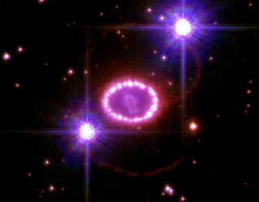 An image of SN 1987A, an example of a Type II-P supernova.