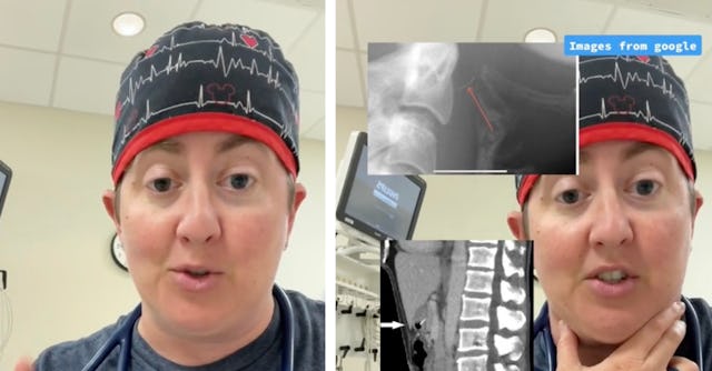 A pediatric ER doctor shared a video in which she describes a young boy who swallowed wire from a gr...