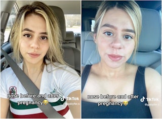 People are talking about pregnancy nose and pregnancy lips all over TikTok.