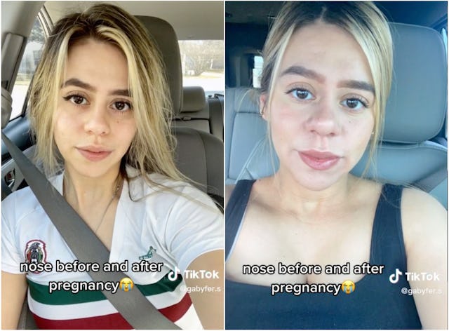 People are talking about pregnancy nose and pregnancy lips all over TikTok.