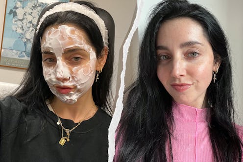 An honest review of Sofwave, the skin-tightening treatment everyone's been buzzing about.