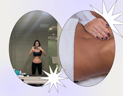 Why you need to use a roller pin after liposuction - Snatched body