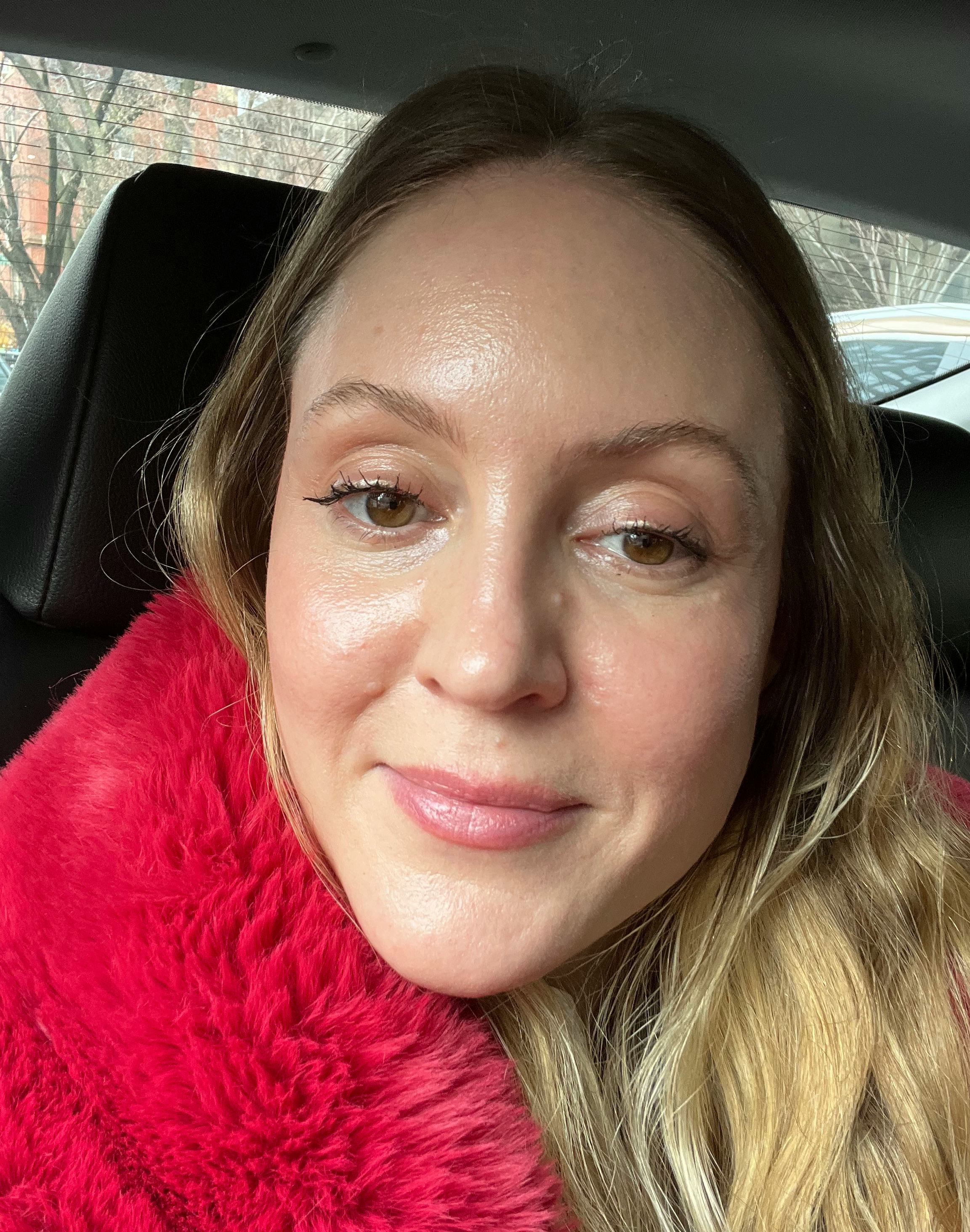 An honest review of the Emface treatment.