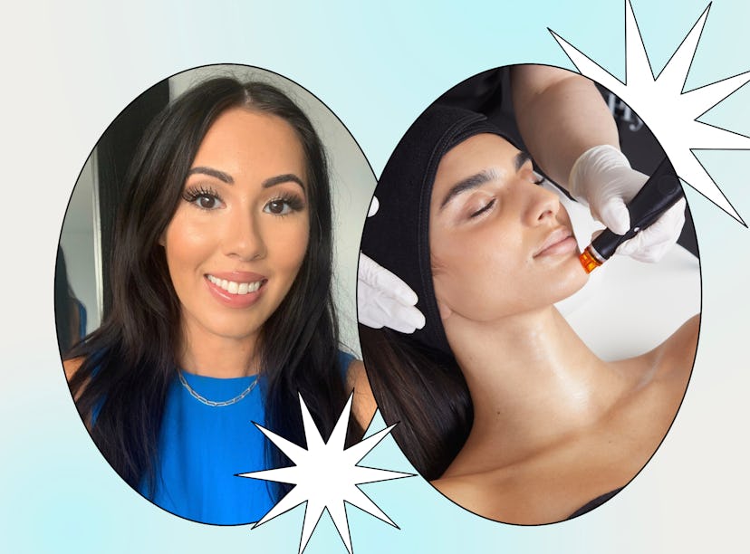 A woman gets a hydrafacial treatment at a spa.