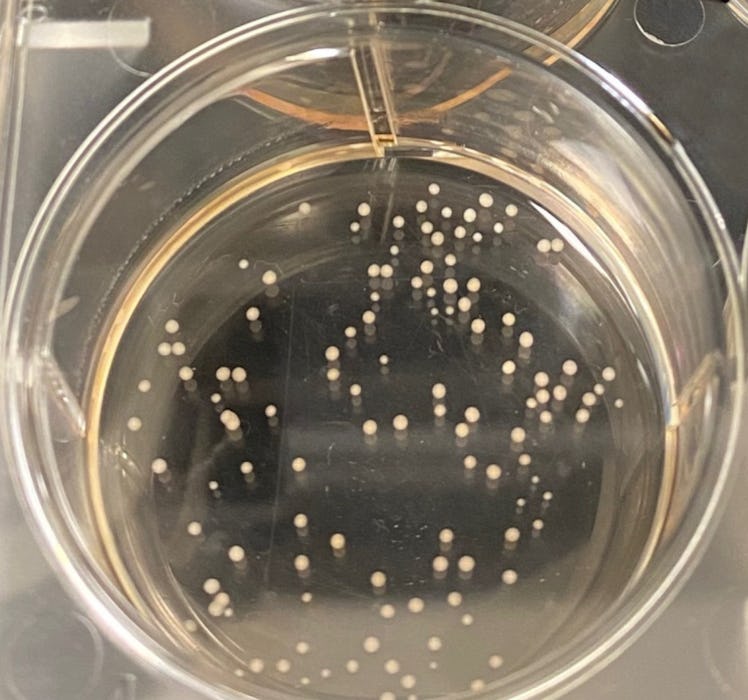 An image of organoids in a petri dish at Johns Hopkins.
