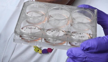 An images of organoids in petri dishes created in Hartung's lab.