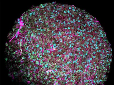 An image of a brain organoid created in Hartung's lab that could eventually power computers.