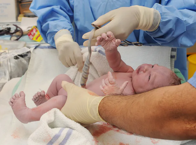 Some parents choose to preserve the memory of birth through umbilical cord keepsakes.