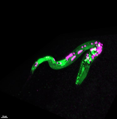 A glowing worm. Green dots represent neurons that react to cannabinoids