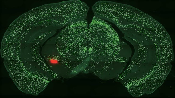 A scan of a mouse's brain in green and a red dot representing the amygdala