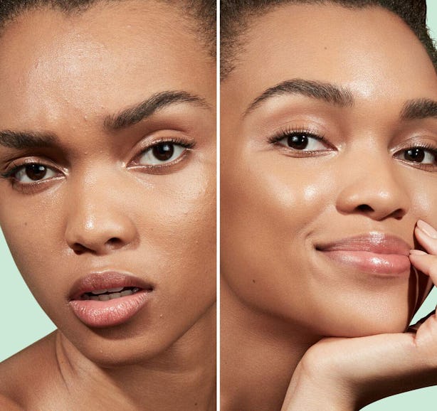 The 6 Best Primers For AcneProne Skin, According To Dermatologists