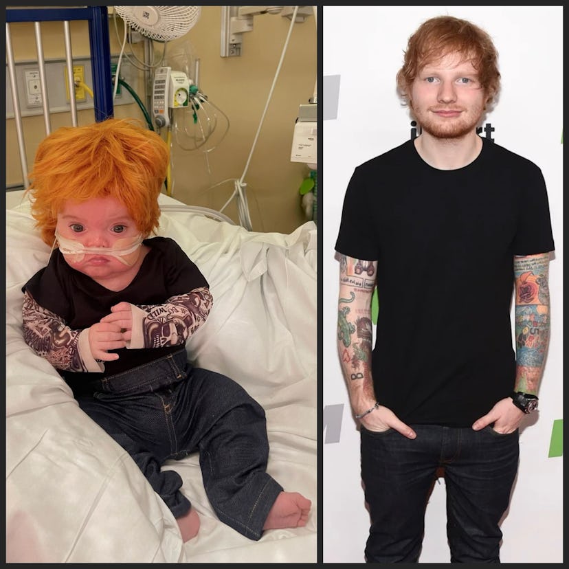 A NICU baby dressed up as Ed Sheeran.