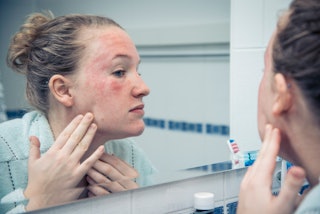 A woman looks at a rash on her face