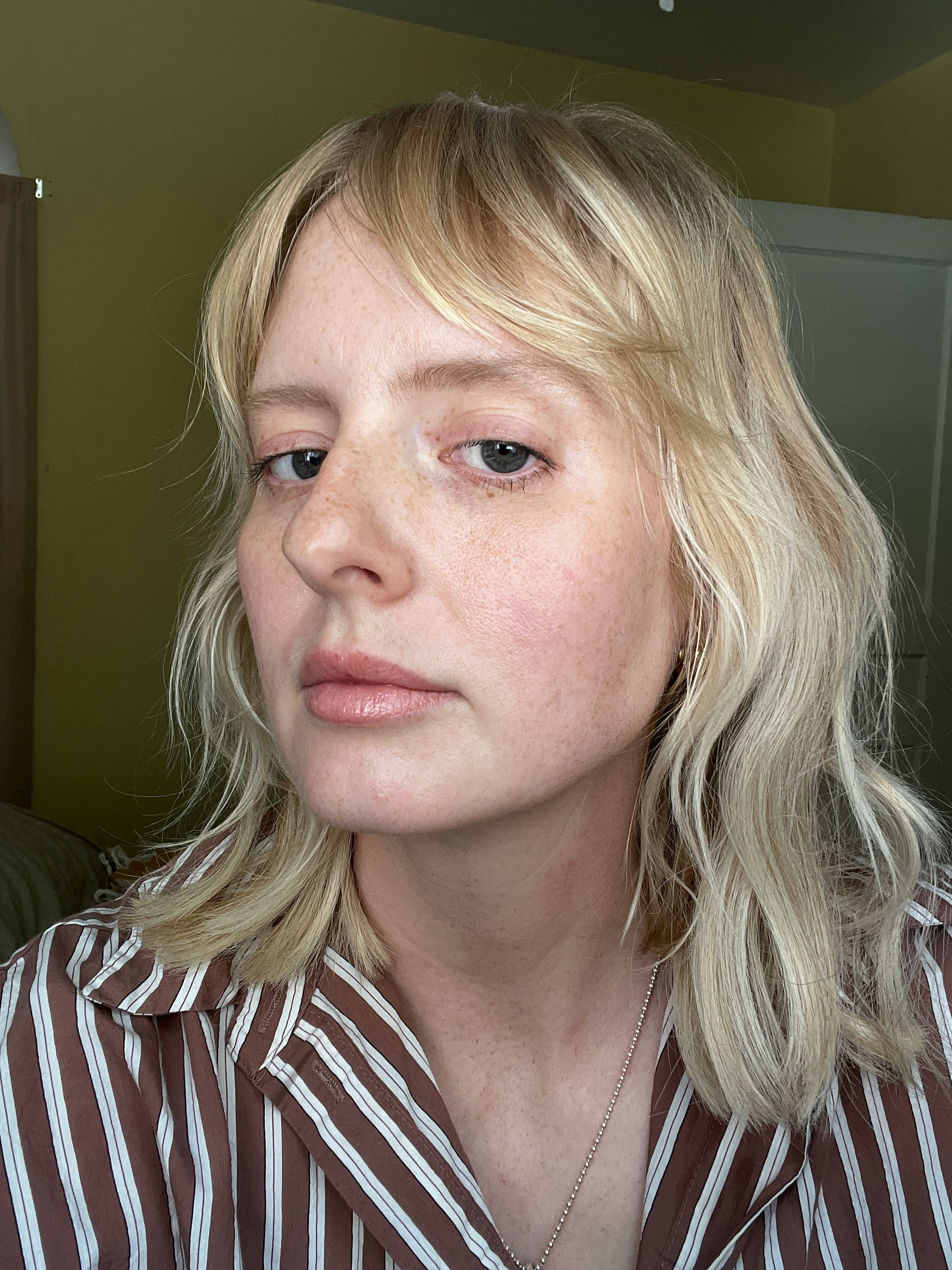 plasma pen treatment review