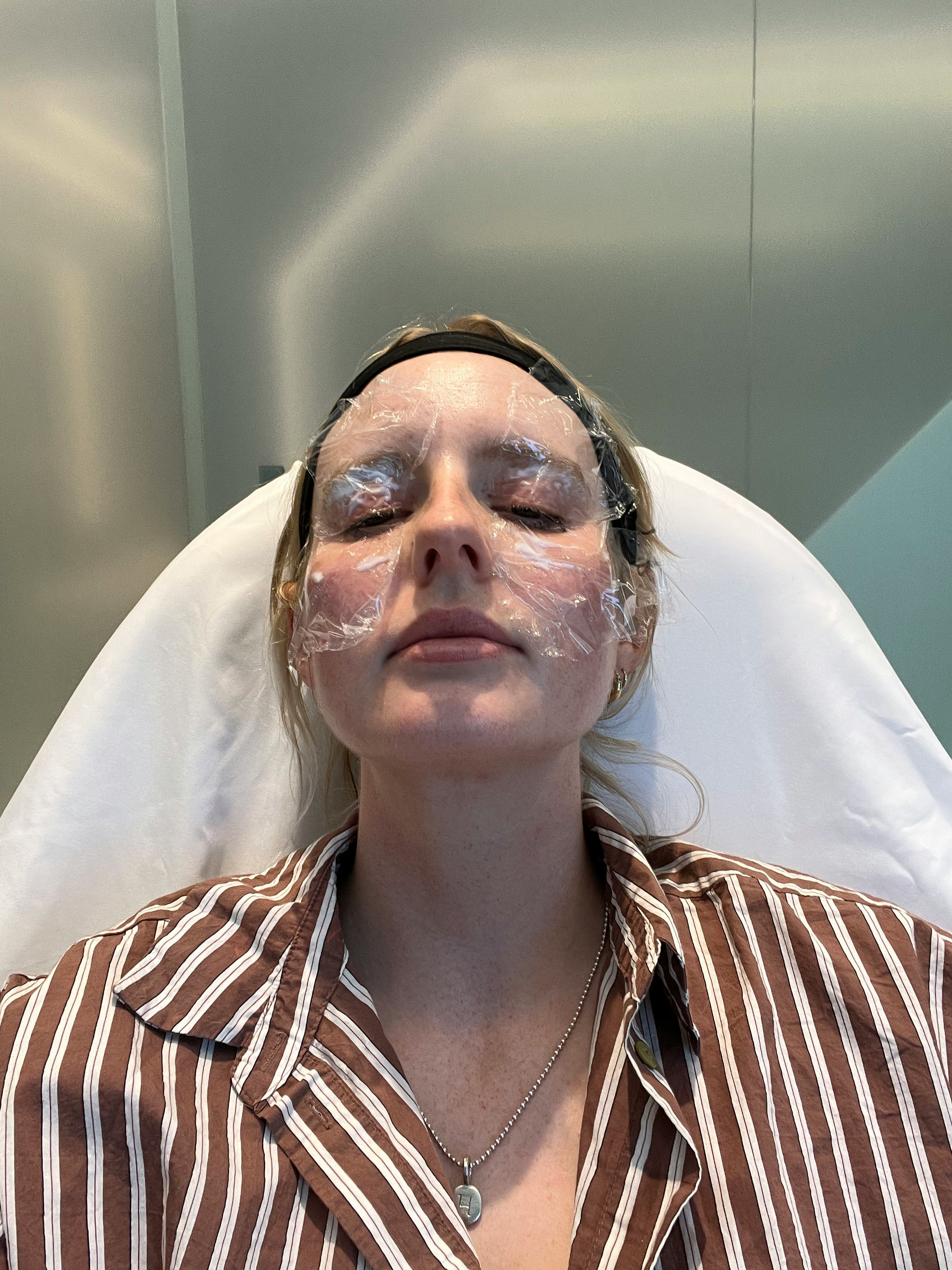 Trying a plasma pen treatment for the under-eye area.