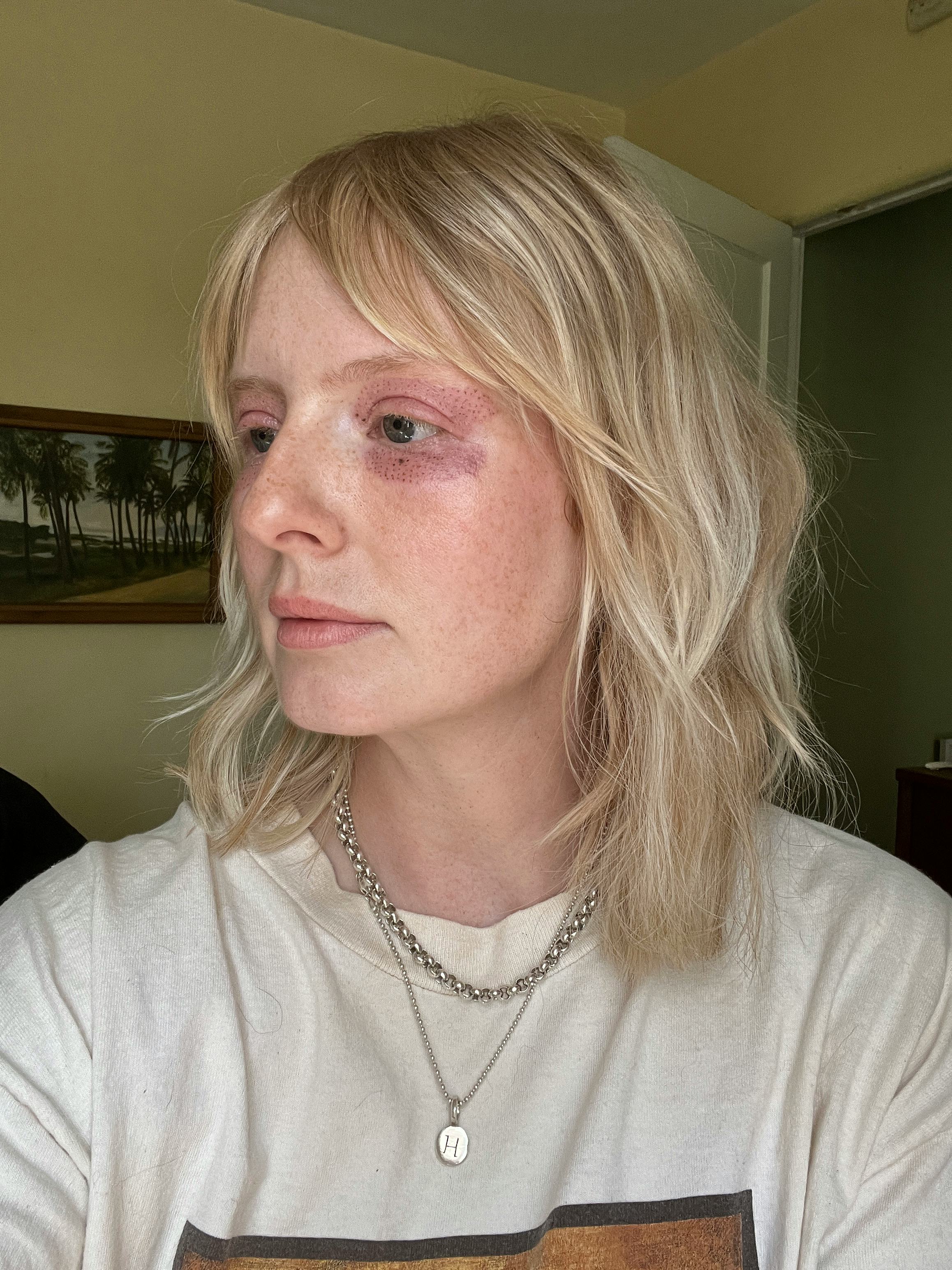 Louise Walsh plasma pen review.