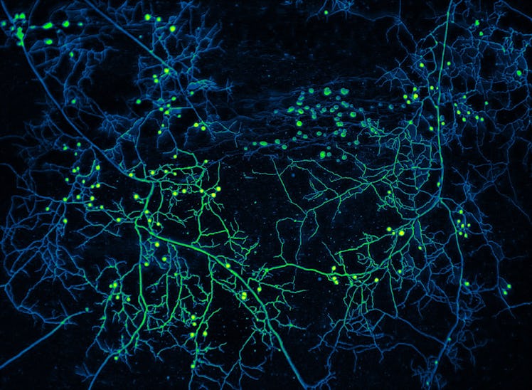 Fluorescent visualization of mycorrhizal fungi