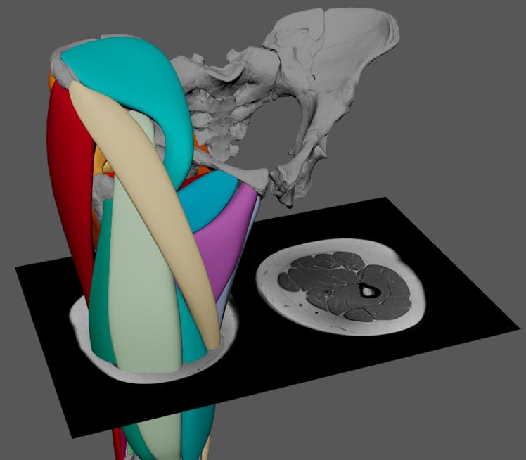 A digital image of a human pelvis.