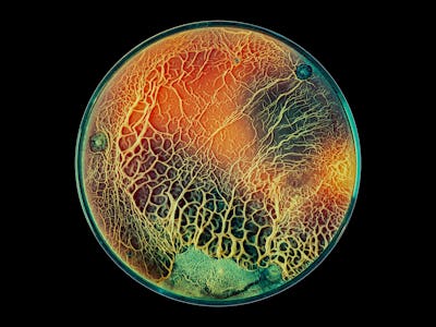 A photograph of fungi growing in a petri dish.