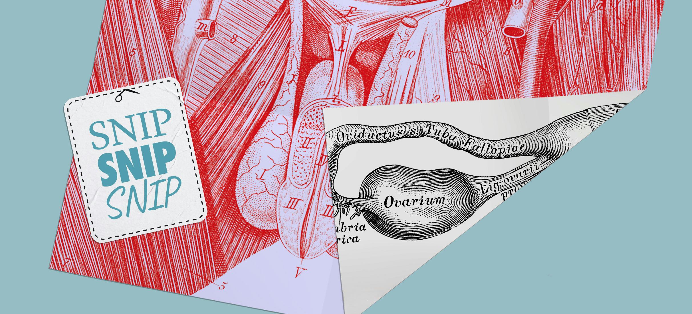 Tubal Ligations Are Riskier Than Vasectomies But Performed Far More Often