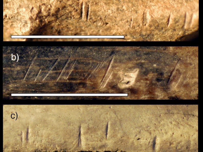 Image of human bones.