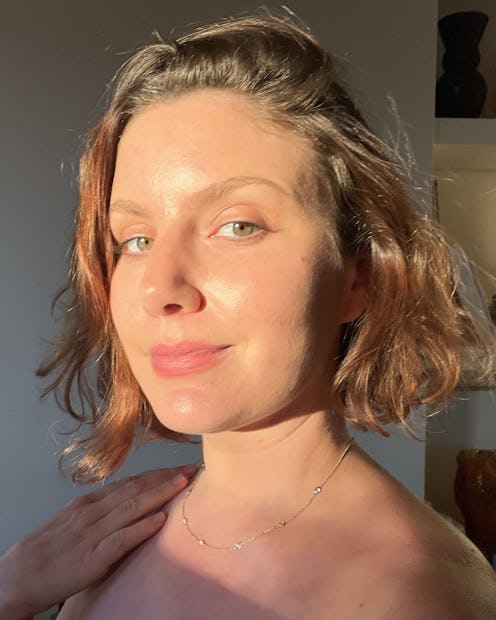 How sun exposure affects fillers