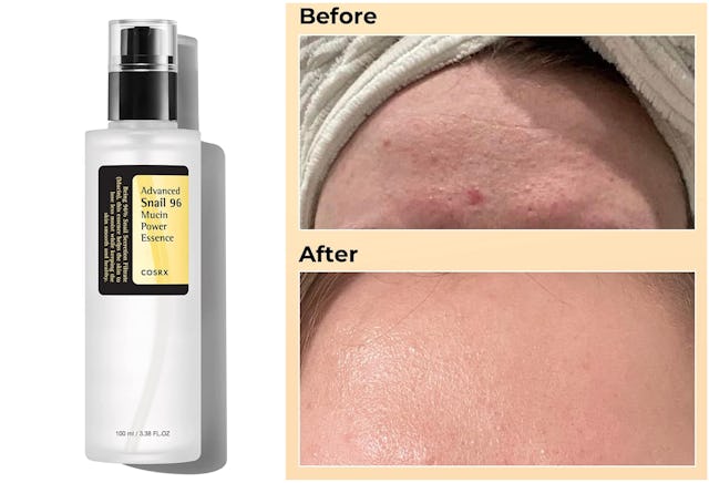 COSRX Snail Mucin Power Repairing Essence on Amazon
